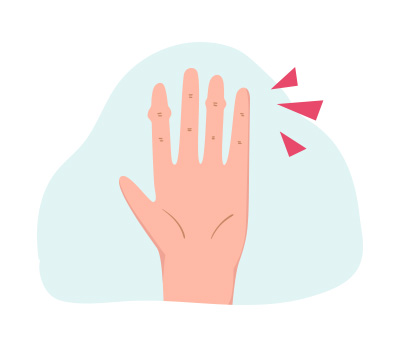 へバーデン結節